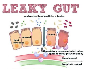 Cartoon illustration of "leaky gut" and how the the intestinal walls are to be tight to avoid toxins and undigested particles to pass through. | MakeSauerkraut.com